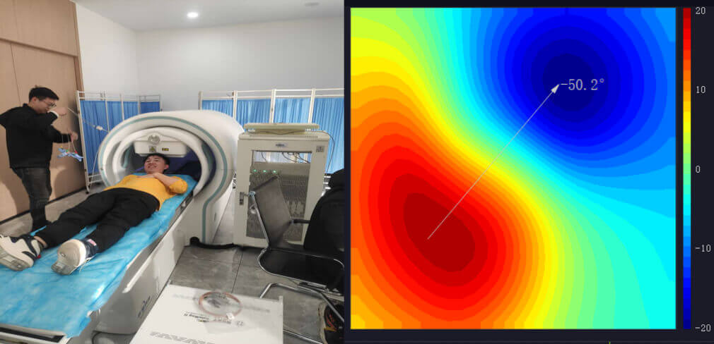 Magnetometro atomico Misurazione magnetica cardiaca