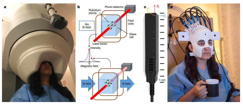 Magnetometro atomico Magnetoencefalografia