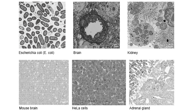 Ricostruzione 3D ad alta velocità e alta risoluzione: la soluzione di microscopia elettronica volumetrica CIQTEK apre nuove dimensioni nella caratterizzazione biologica